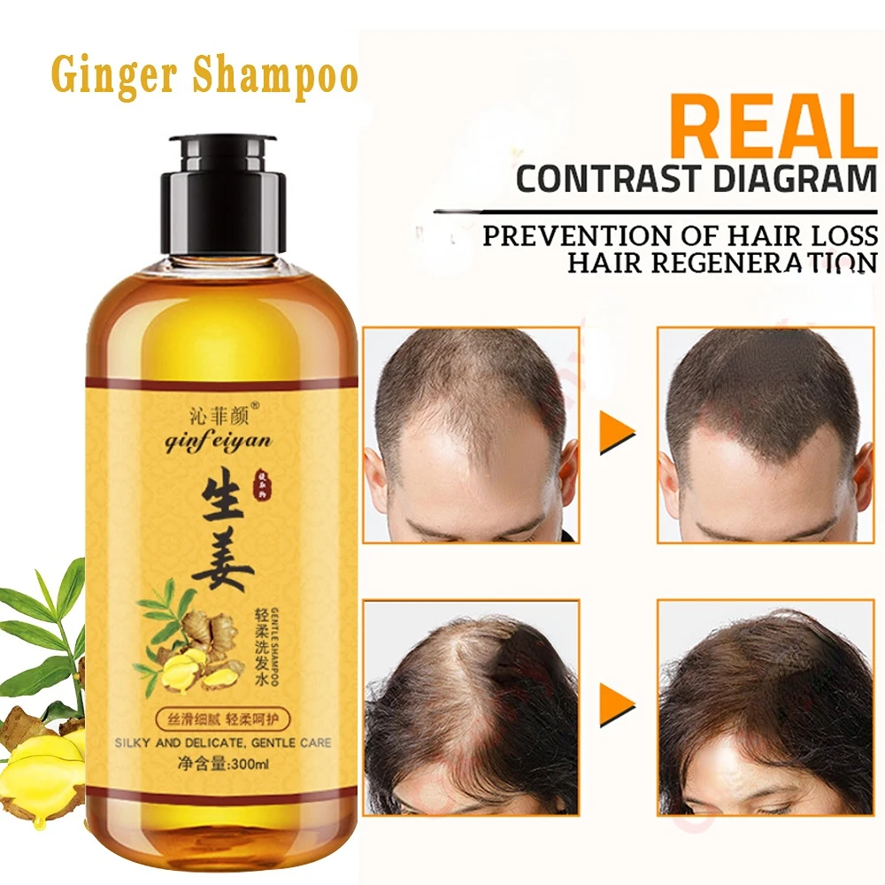 Genuine Professional Hair Ginger Shampoo 300ml, Hair Regrowth Dense Fast, Thicker, Hair Growth Shampoo Anti Hair Loss Product