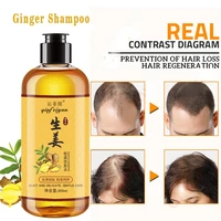 genuine professional hair ginger shampoo 300ml hair regrowth dense fast thicker hair growth shampoo anti hair loss product