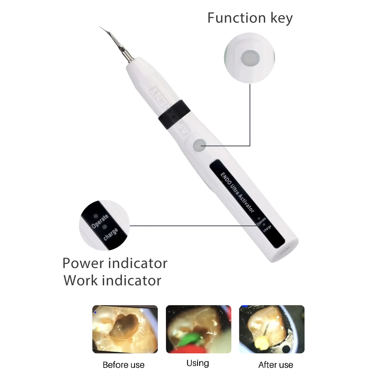 Фото Беспроводной эндодонтический ирригатор Dental Endo Ultra Activator с 6 бесплатными насадками, стоматологический инструмент для корневых каналов №4