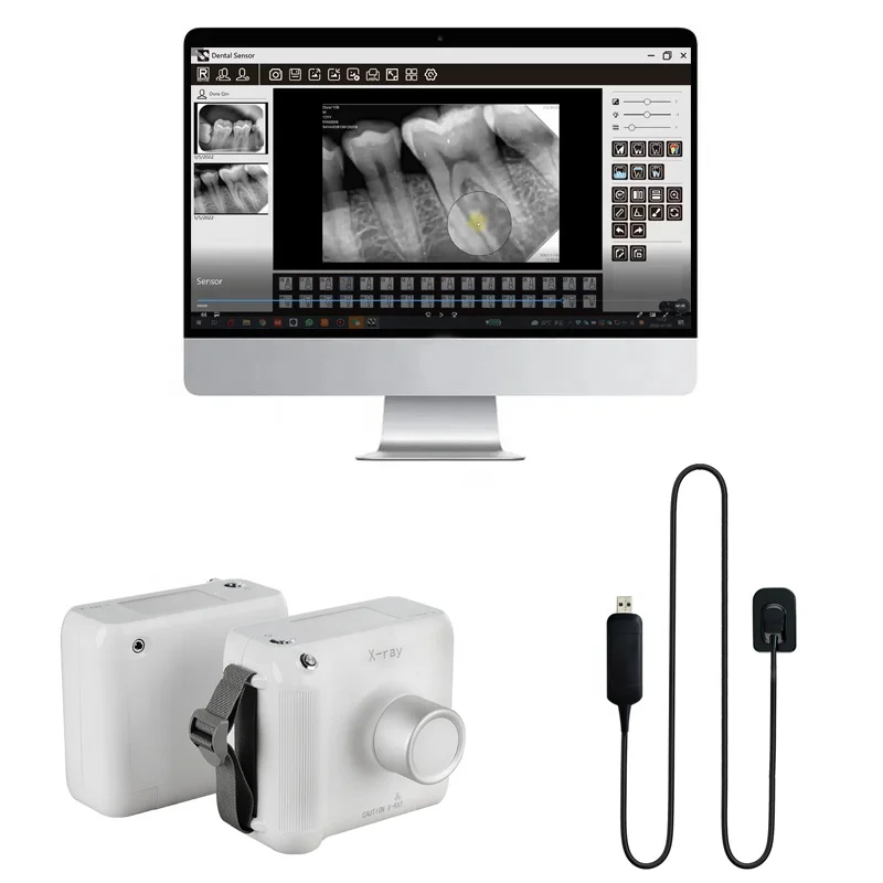 

CMOS APS Oral Clinic Digital Imaging teeth X Ray Rvg