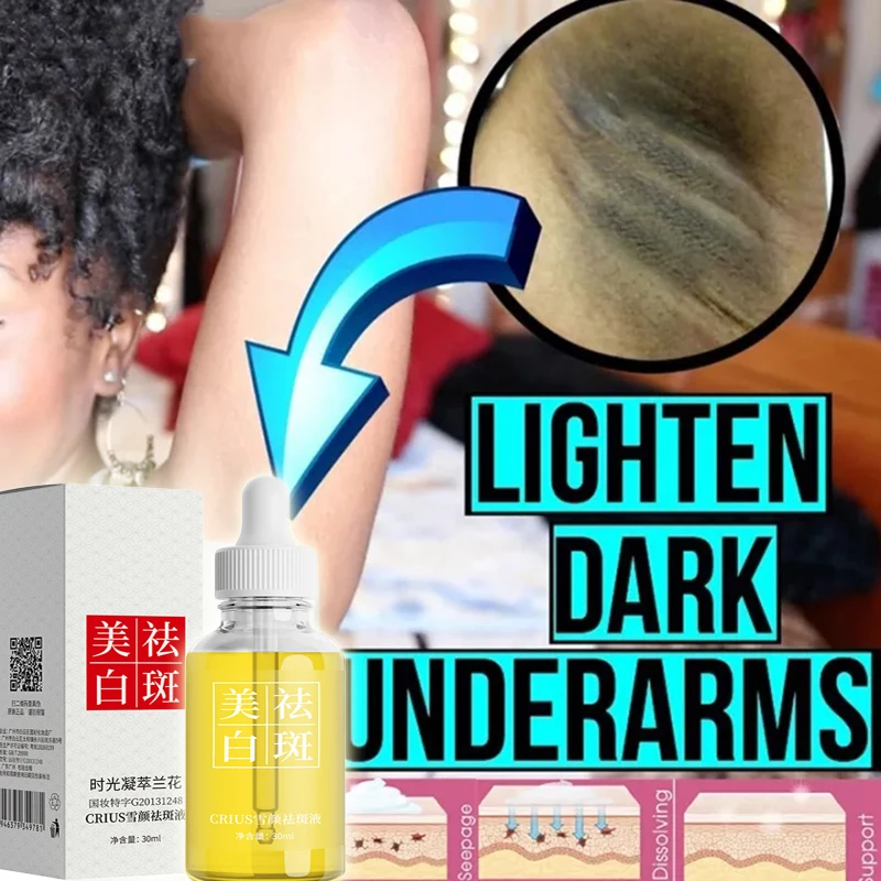 

Отбеливающий крем для тела для подмышек, подмышек, колен, Осветляющий, тусклый, увлажняющий, осветляющий лосьон для ухода за кожей