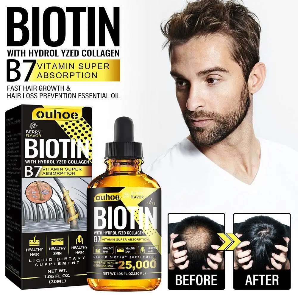 

Hair Growth Products Biotin Fast Growing Hair Care Essential Oils Anti Hair Loss Spray Scalp Treatment For Men Women H7G2