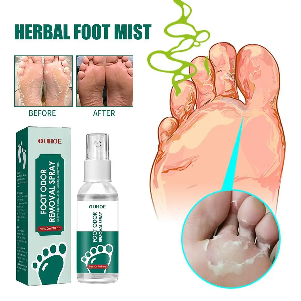 

Athletes Foot Spray Beriberi Cream Deodorant Remove Anti Itch Odor Fragrance Moisturizing Care Dry Peeling Sweat Crack Feet J6Y0