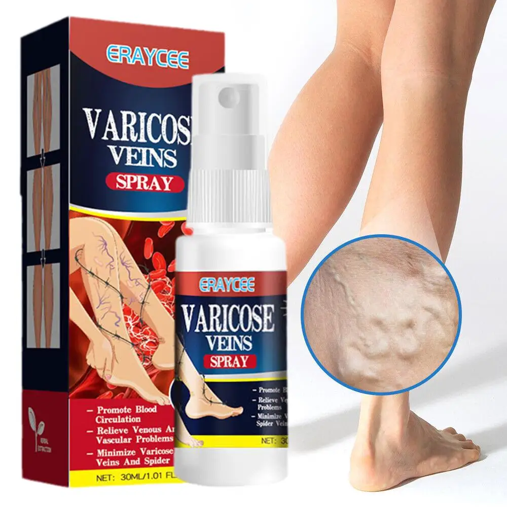 

Спрей от варикозного расширения вен, эффективное средство для облегчения васкулита ног, флебит, паук, лечение боли, уход за ногами, 30 мл