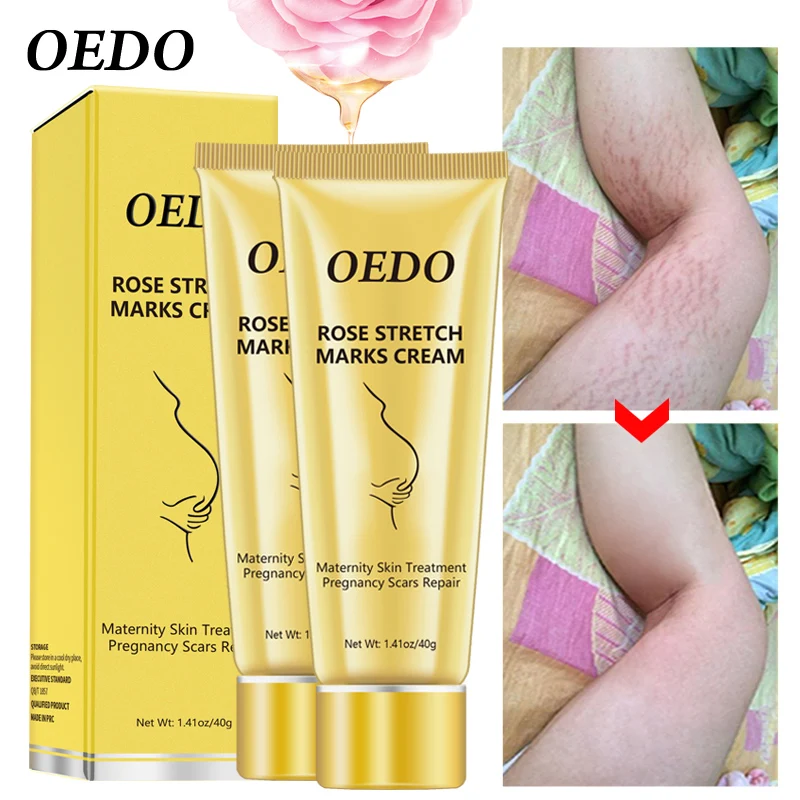 

Rose Removes Stretch Mark Cream To Remove Postpartum Obesity Pregnant Women Repair Anti-Aging Anti-Winkles Firming Body Cream