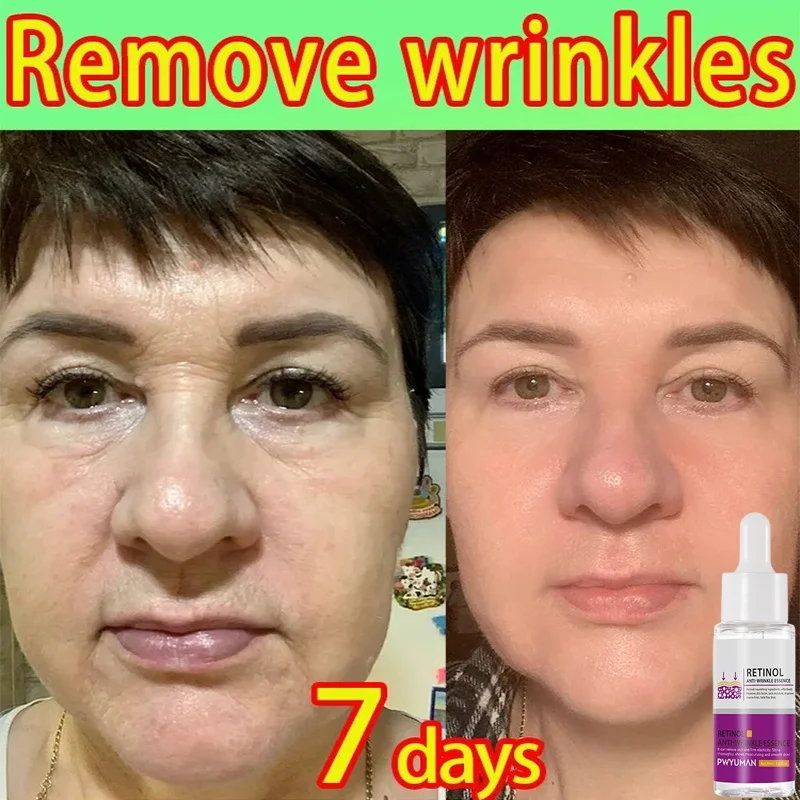 Сыворотка от морщин Niacinamide для ухода за кожей лица антивозрастная лифтинга