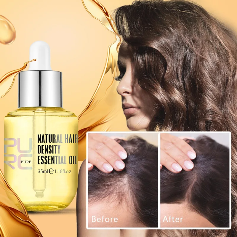 

PURC Hair Growth Products Ginger Extract Serum Prevent Hair Loss Oil Scalp Treatments Fast Growing Hair Care for Women 35ml