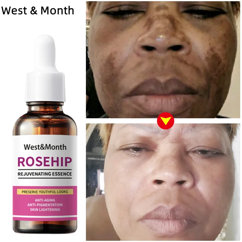 For Face-pure Cold Pressed Facial Oil,natural Non-greasy Moi