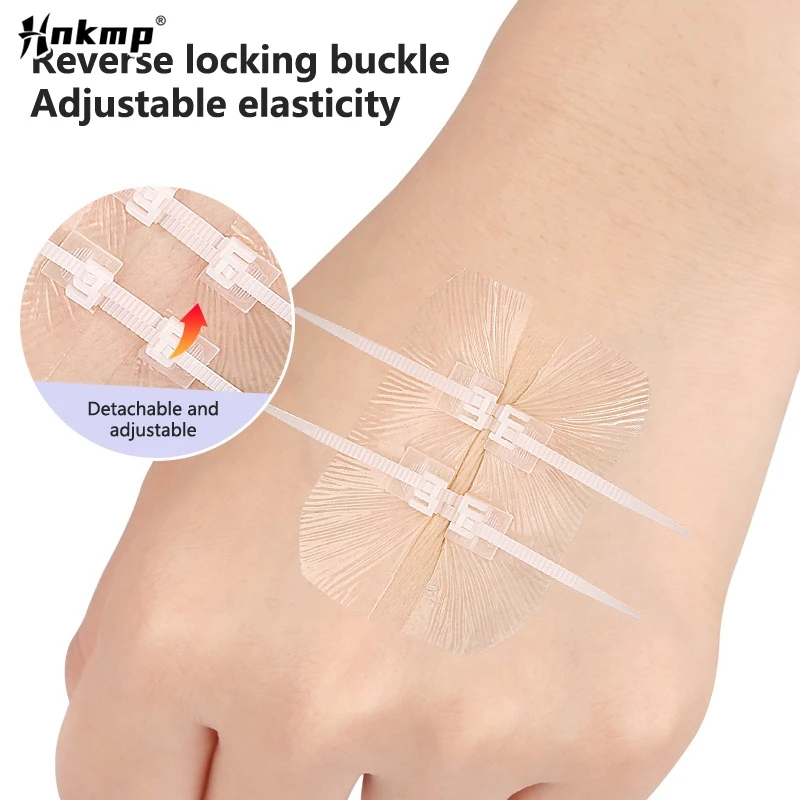 Повязки для ран с застежкой-молнией аварийные зажимы клейкие бесшовные