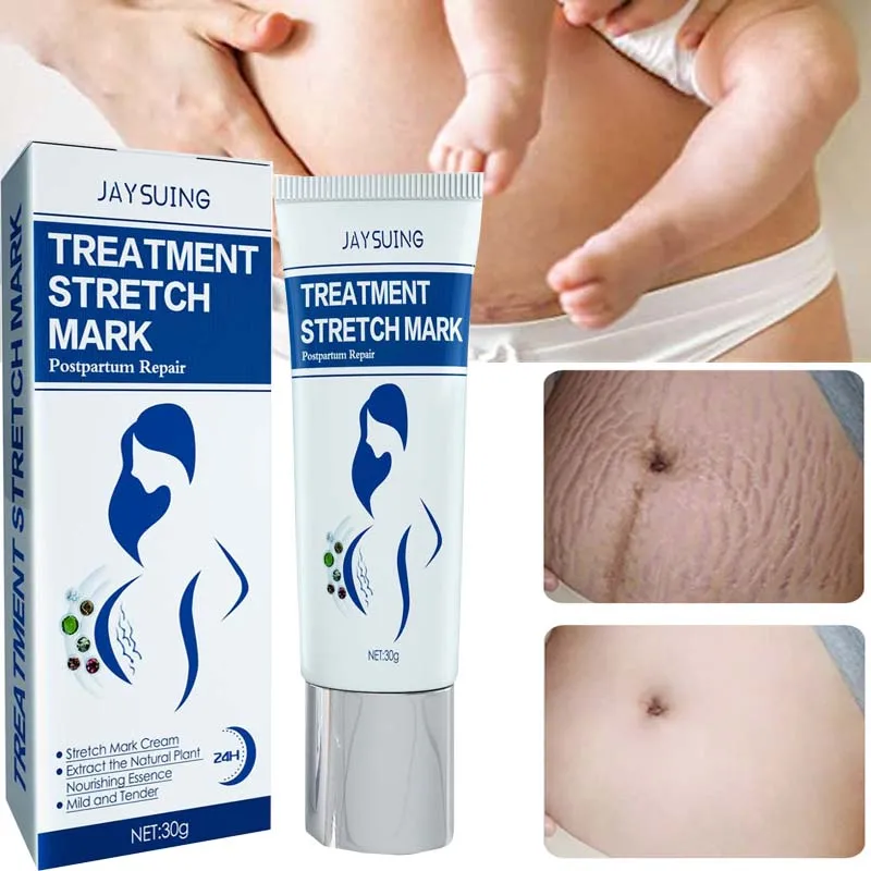 

Крем Для Удаления растяжек и шрамов, увлажняющий антивозрастной крем для беременных женщин