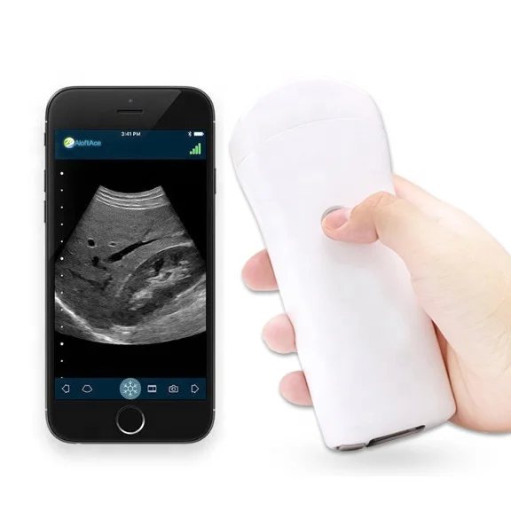 

New Wireless Smart Phone Wifi Iphone Ultrasound Probe