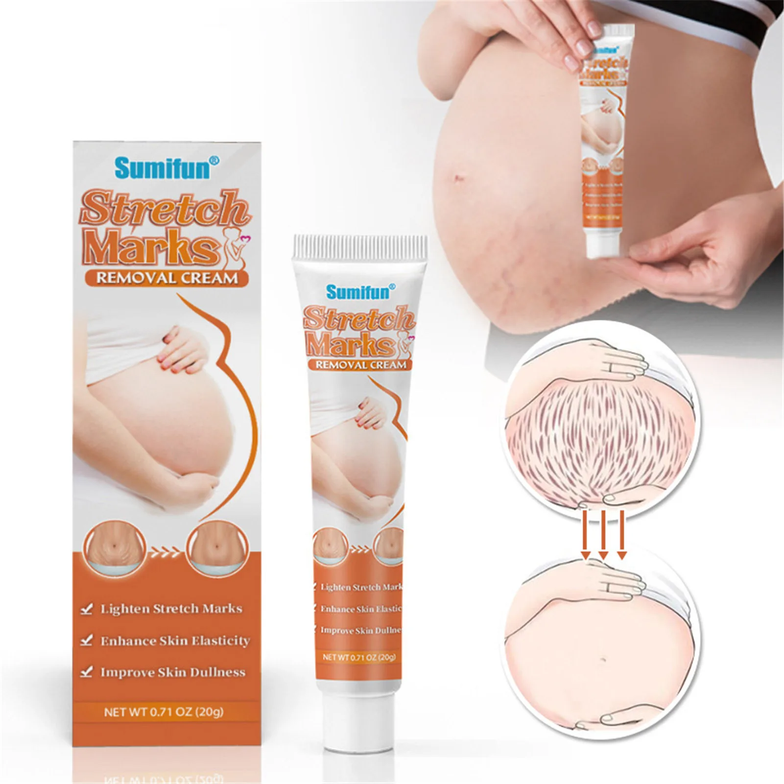 

20g Stretch Marks Removal Cream Belly Creams Intensive Stretch Mark Cream Obesity Stretch Mark Moisturizing Scar Remove Cream