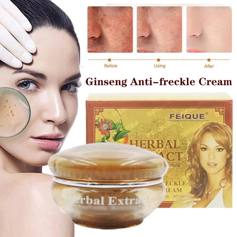 Natural Herbal Whitening Cream Freckles Melasma Remove Dark Spot Face Cream, Anti Melanin for All Skin Type
