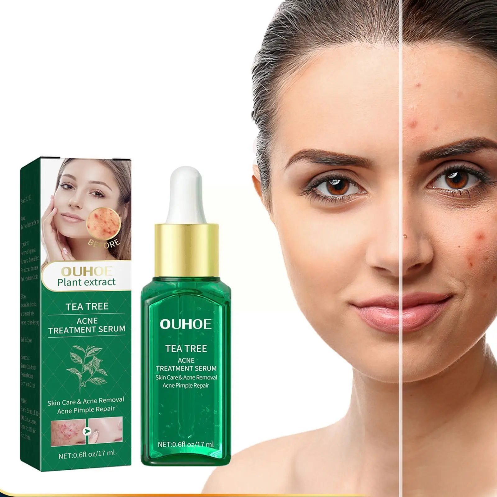 

17ml Acne Treatment Face Serum Mask Anti Acne Pimple Remover Facial Cream Care Skin Moisturizing Essence Whitening Scar I4G7