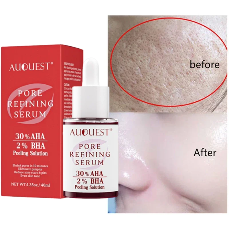 

2% Salicylic Acid Shrink Pore Essence Fruit Acid Anti-acne Serum Anti-Aging Whiten Moisturize Oil Control Face Skin Care Product