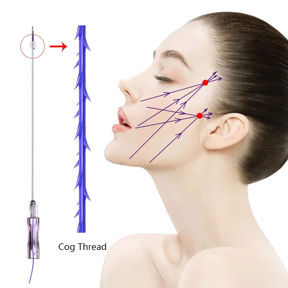 

PDO Mono / COG3D / COG4D / COG6D / Nose / Multi / Fish / Double Needle