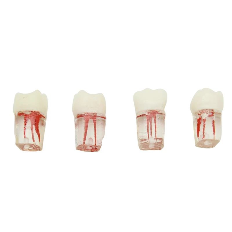 

Стоматологическая модель зубов, 4 шт., блок корневого канала, зубная целлюлоза, полимерная модель для обучения эндоскопии, Стоматологические принадлежности