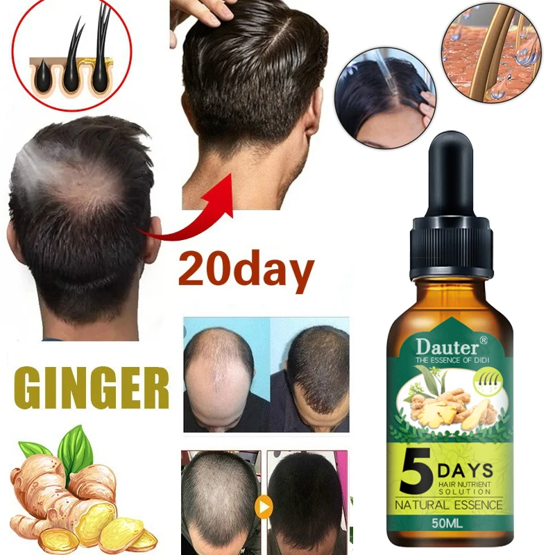 

5 Days Ginger Hair Growth Spray Serum Anti Hair Loss Products Fast Grow Prevent Hair Dry Frizzy Damaged Thinning Repair Care