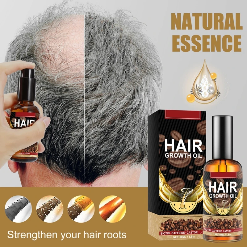 

Fast Hair Growth Serum Essential Oils Ginger Treatment Hair Loss Essence Nourishing Soften Scalp Repair Damaged Hair Care Serum