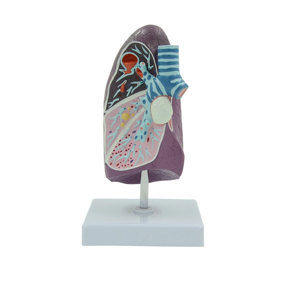 

Human Lung Model Pathological Lung Anatomy Model Human Organ Model for Doctors Office Educational Tool