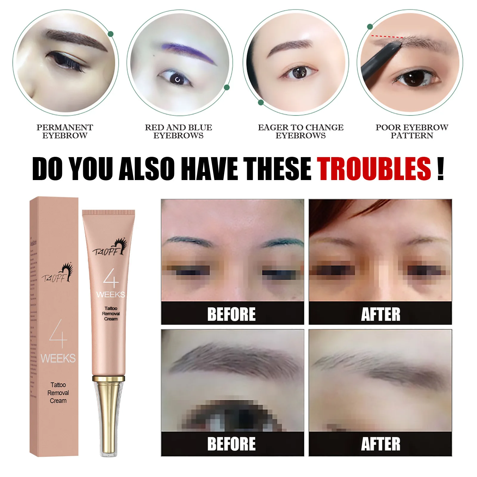 

New Painless Tattoo Removal Cream 1PCS Permanent Moisturize Skin Tattoo Remover Gel Maximum Strength Body Tattoo Cleaning