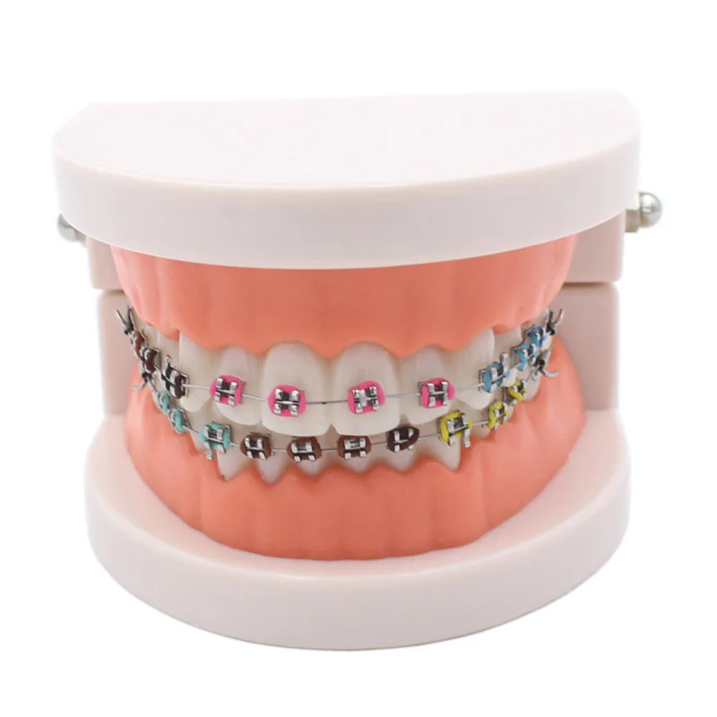 

Dental Orthodontic Treatment Model With Ortho Metal Ceramic Bracket Arch Wire Buccal Tube Ligature Ties Dental Tools Dentist Lab