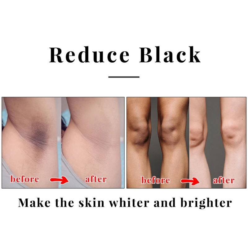 2 шт. койевая кислота мыло для лица тела ванны безопасное натуральное мужчин и