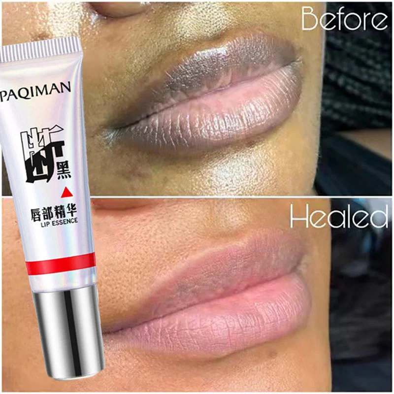 

Lip Black Removal Serum Pink Bleaching Balm Remove Dark Smoke Lip Whitening Essence Moisturizing Nourish Lipstick Lip Primer