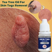 organic tags solutions serum painless mole skin dark spot remover serum freckle face wart tag removal essential oil