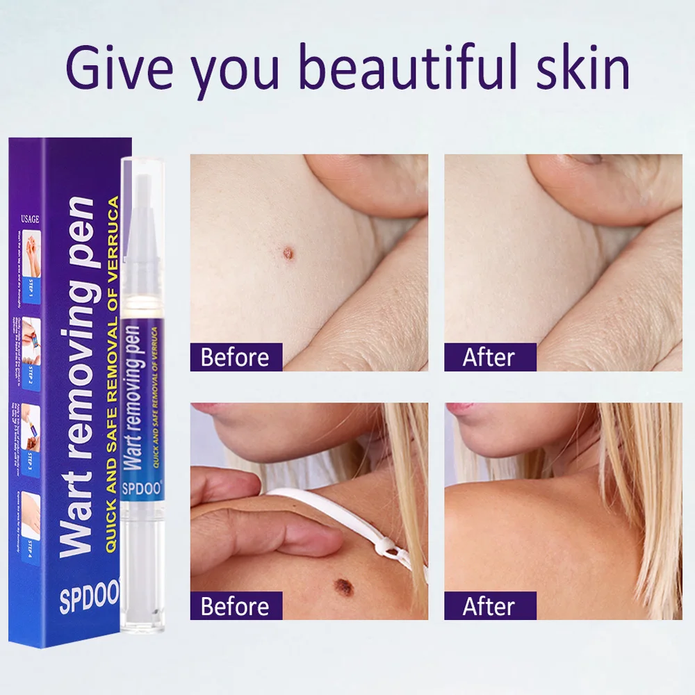 Рисунок 5 - Новинка, средство для удаления бородавок