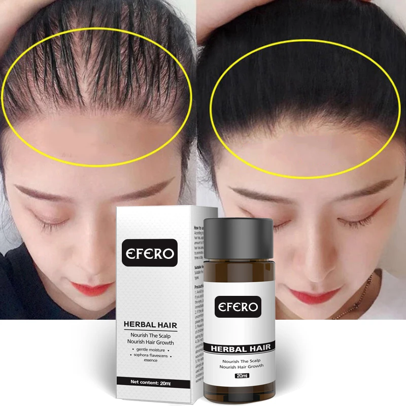 

Efero 20ml Ginger Hair Growth Essential Oil Serum Hair Treatment Anti Lost Fast Grow Repair Scalp Frizzy Damaged Hair Care TSLM1