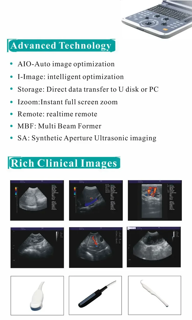 Рисунок 4 - Ультразвуковой Доплер для ноутбука