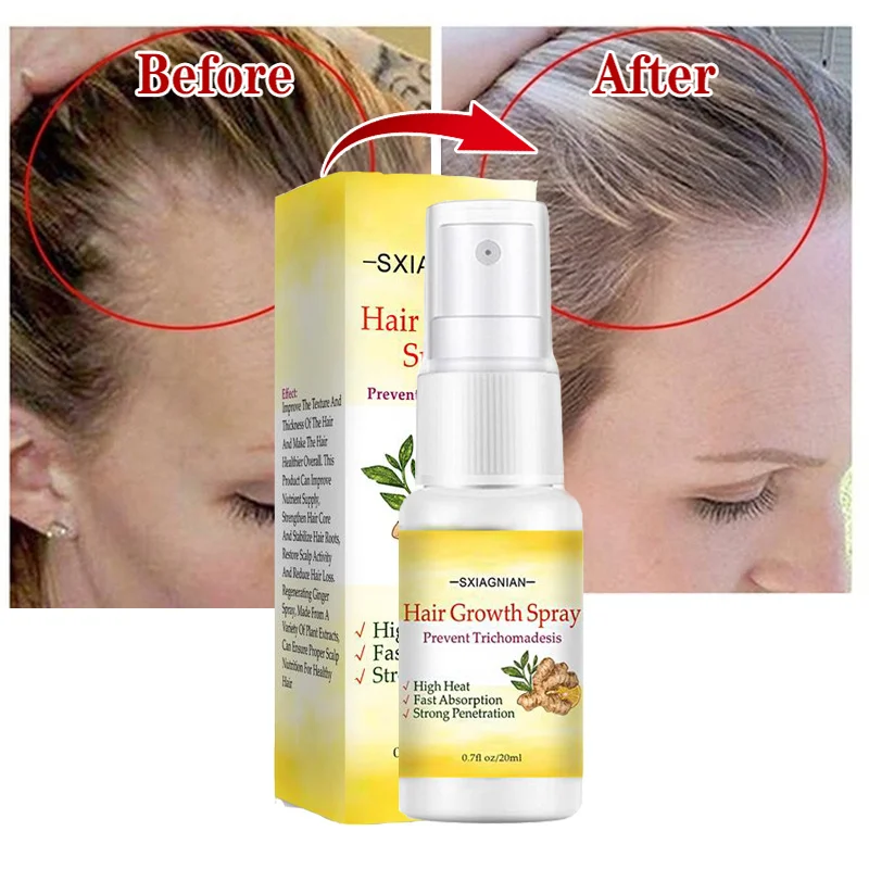 Fast Hair Growth Spray Serum Anti Hair Loss Treatment Essence Oil Repair Nourish Hair Roots Prevent Baldness For Men Women