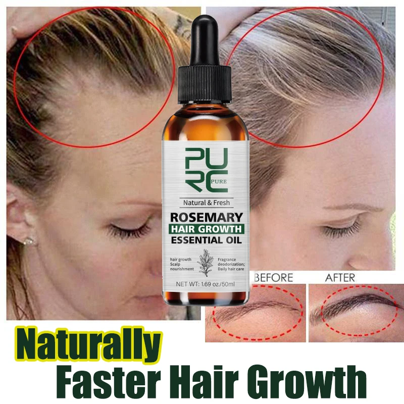 

Эфирное масло для роста волос средство для предотвращения роста волос розмарином, жидкость для быстрого роста, натуральная кожа головы, питает, сияющий, здоровый уход за волосами, 50 мл