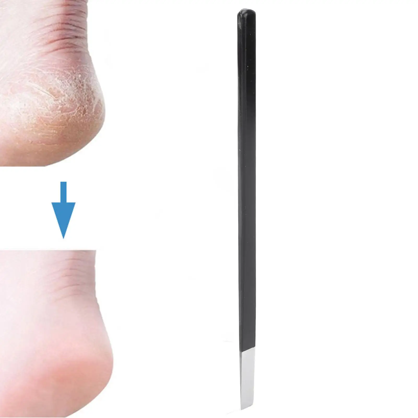 Педикюр из нержавеющей стали — средство для удаления кутикулы и омертвевшей