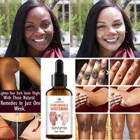 joint de blackening skin care liquid knee and ankle lightening melanin moisturizing moisturizing skin rejuvenation 30ml