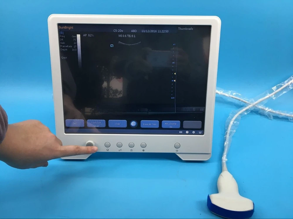 Clinic 15 inch LCD portable laptop touch screen ultrasound