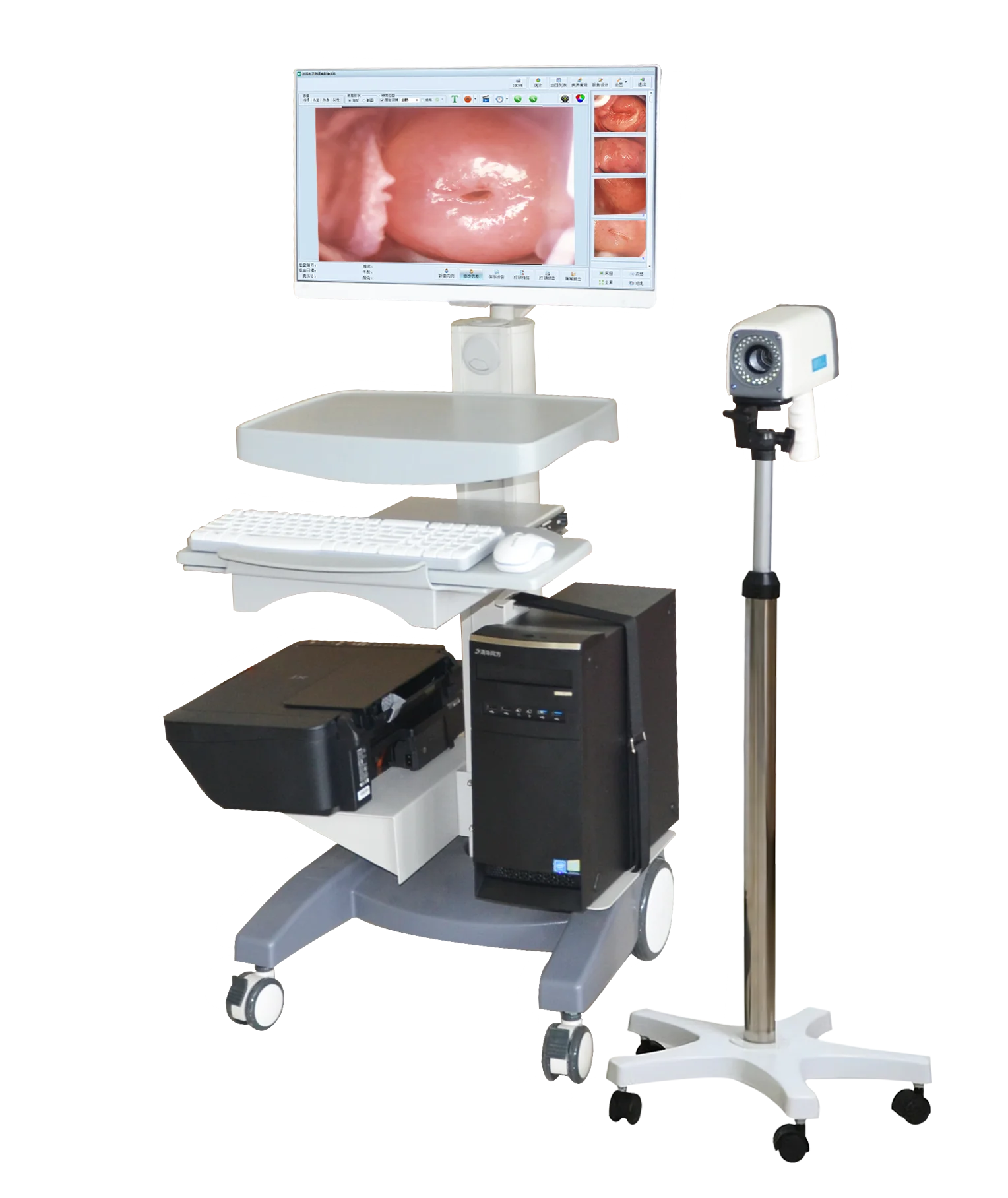 

Hospital digital good quality full HD Colposcope documentary workstation with trolley and computer