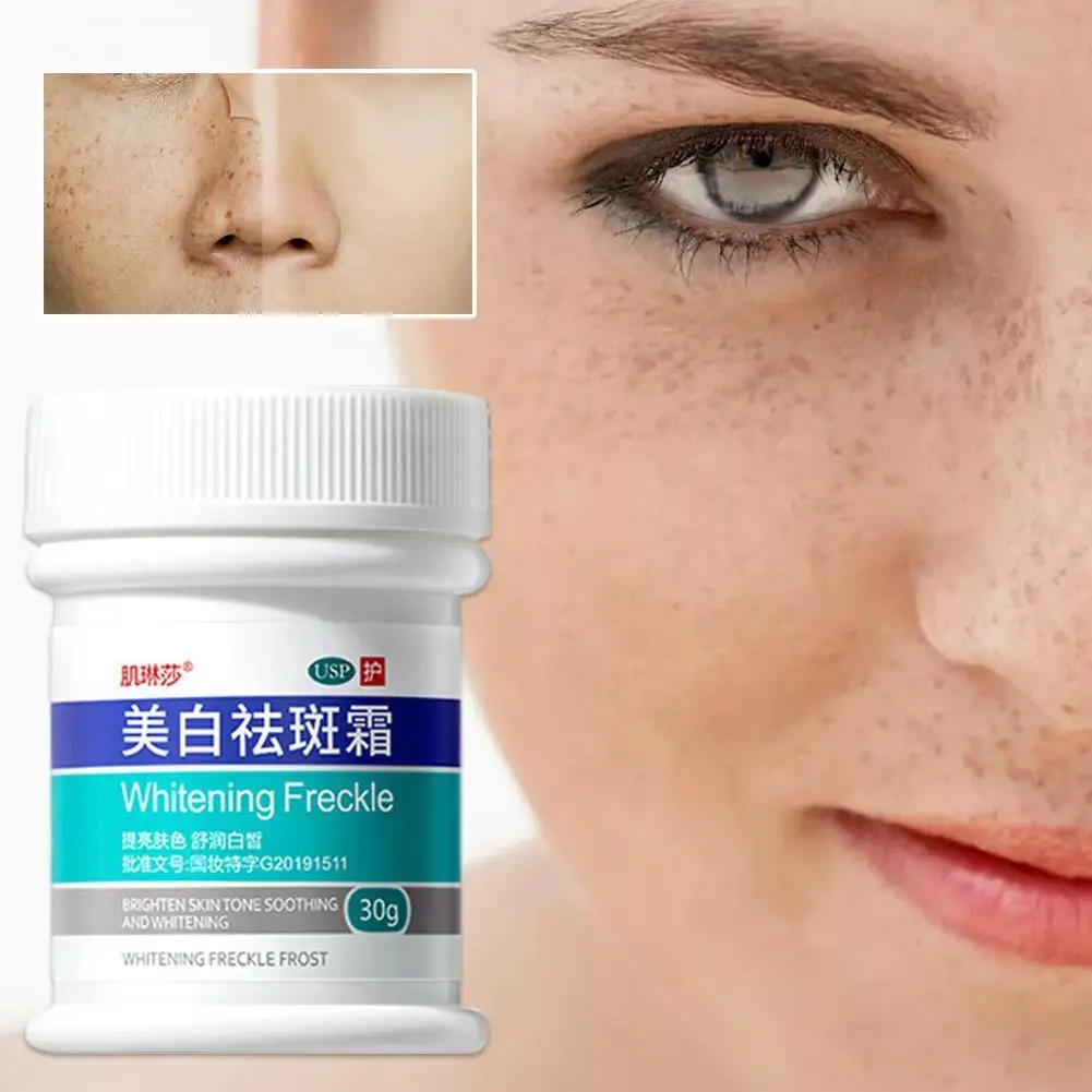 

30g Whitening And Freckle Removing Cream Lightens Freckles And Melasma Improves Skin Lightens Dull Pigment A9H0