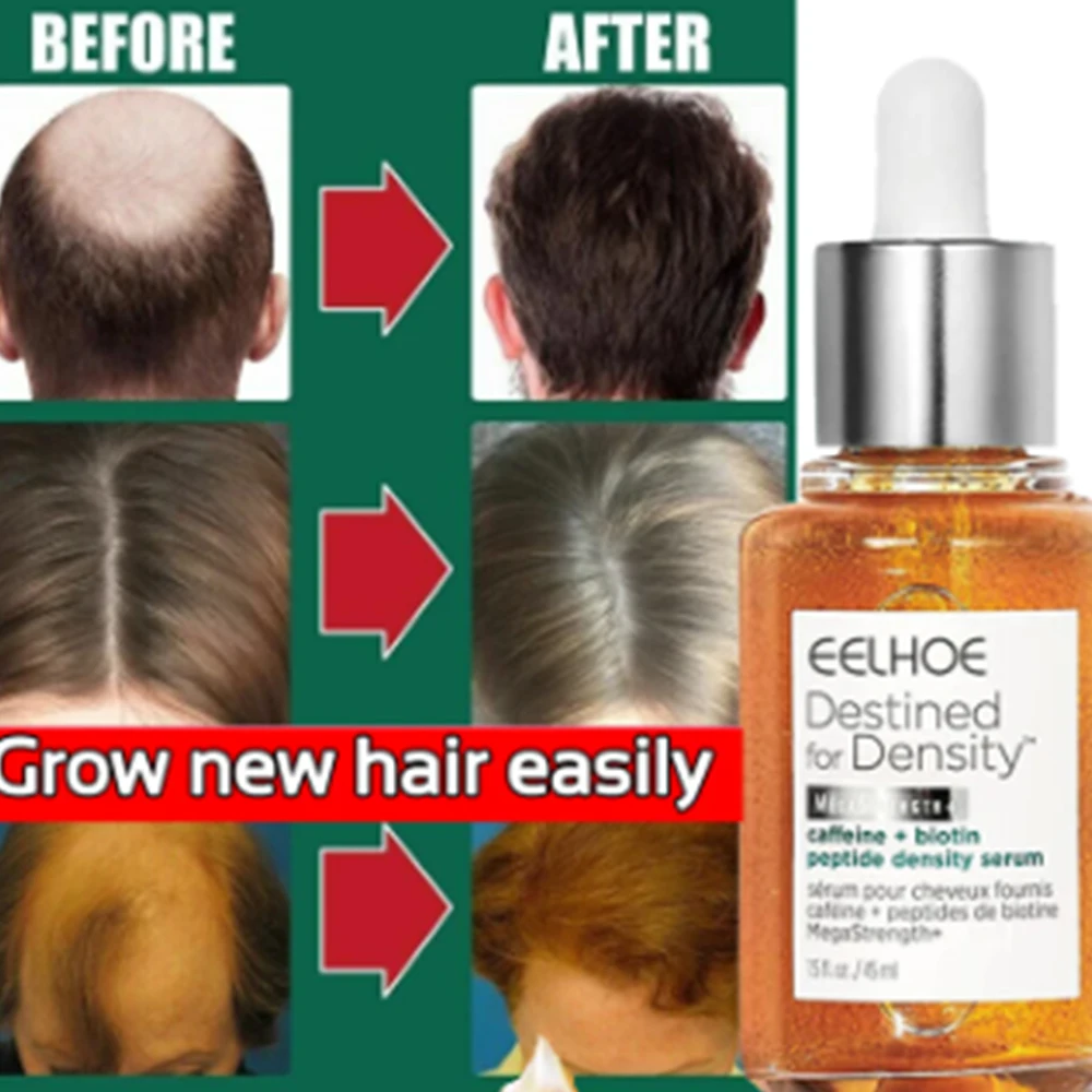

Эссенция для быстрого роста волос масло увлажняет кожу головы, густые волосы, против выпадения волос, уход за волосами, эссенция, продукты для ухода за волосами