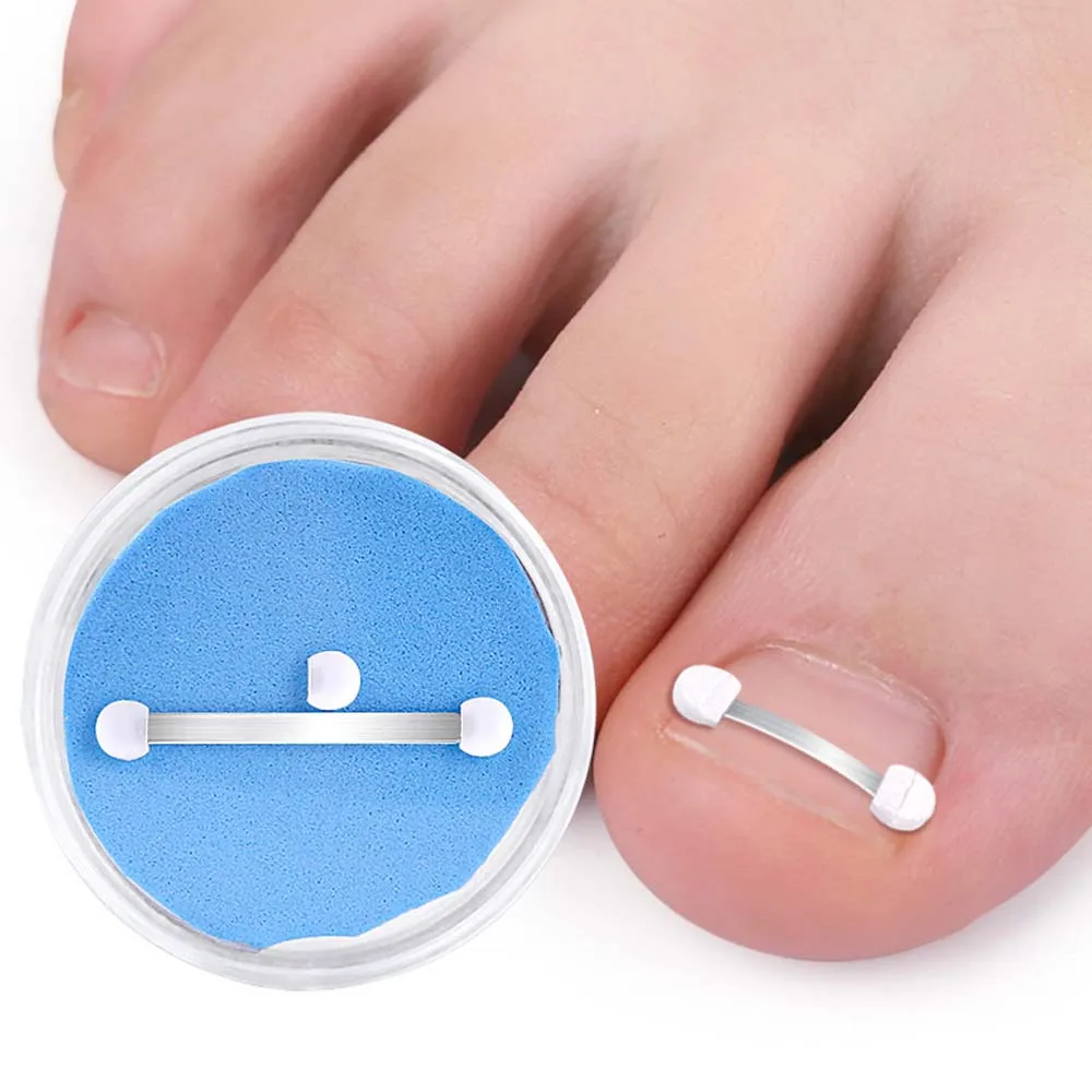 

Recover Toe Splint Support Relief Toenail Straightener Ingrown Toenails Corrector Bunion Corrector Toenail Fixer