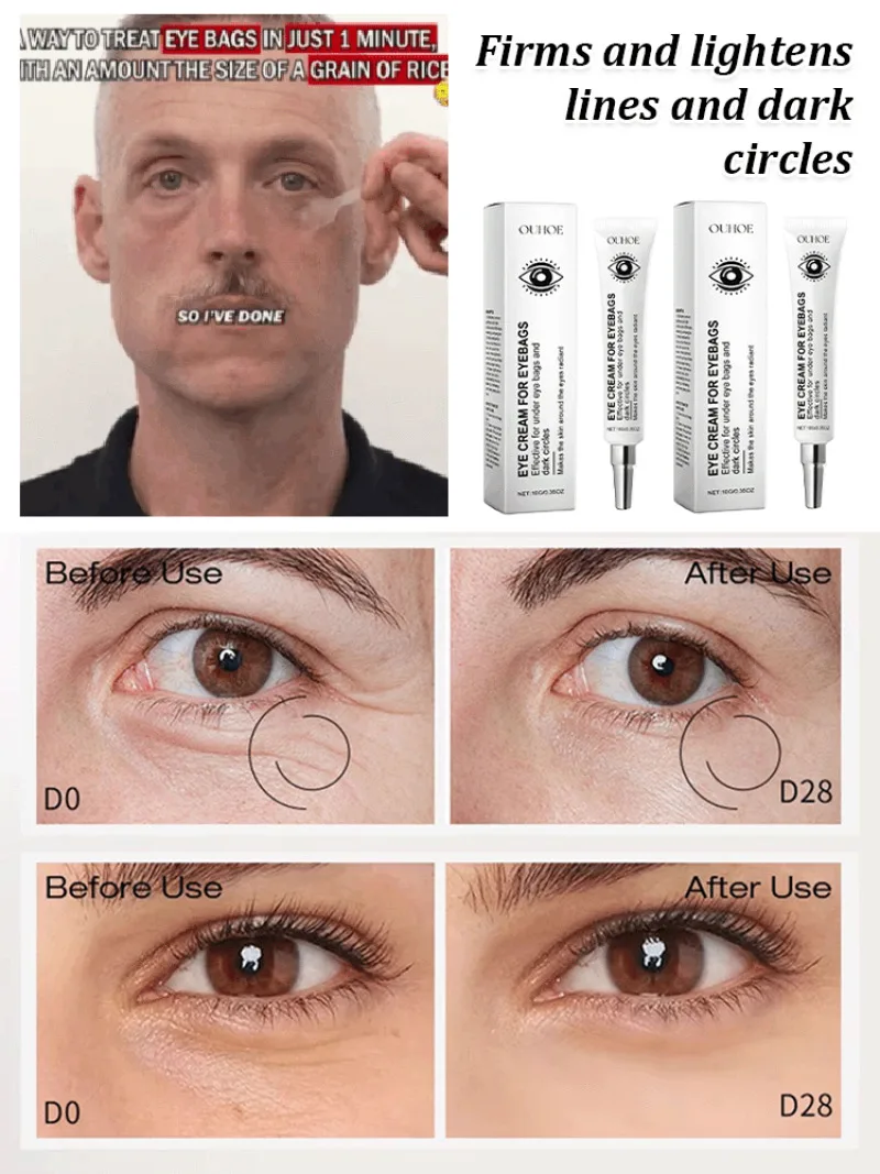 Укрепляющий увлажняющий крем для век мгновенное увлажнение Смягчающий сухих