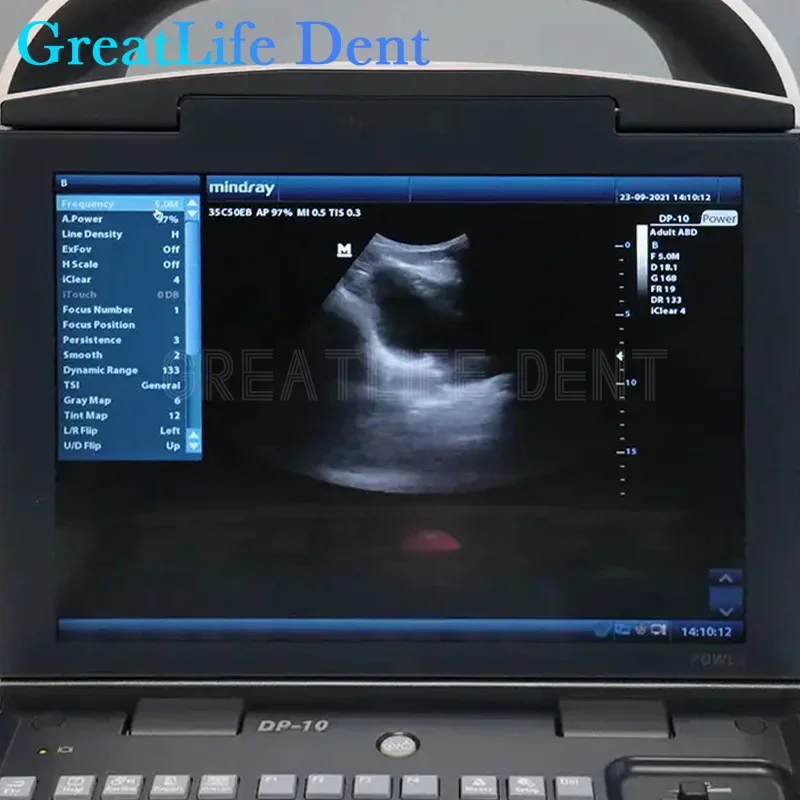 GreatLife портативное устройство для ультразвуковой терапии в черном и белом цвете с