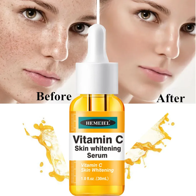 

Vitamin C Whitening Freckles Serum Remove Melanin Melasma Dark Spots Face Essence Brighten Anti-Aging Firm Skin Care Cosmetics