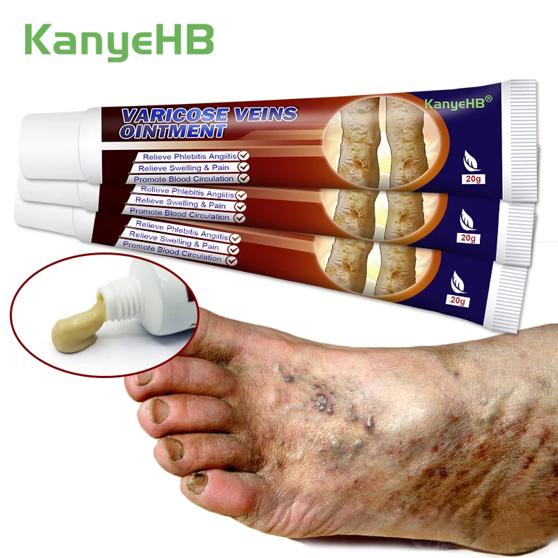 

1/3/5 шт., пластырь от варикозного расширения вен