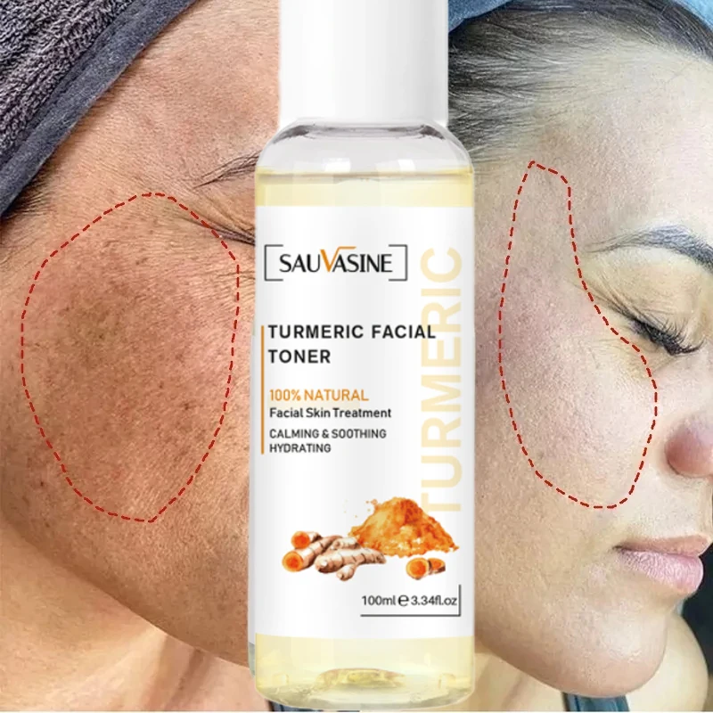 

Turmeric Facial Toner Anti Aging Acne Dark Spot Removal Whitening Face Serum Ginger Moisturizing Skin Brighten Essential Liquid