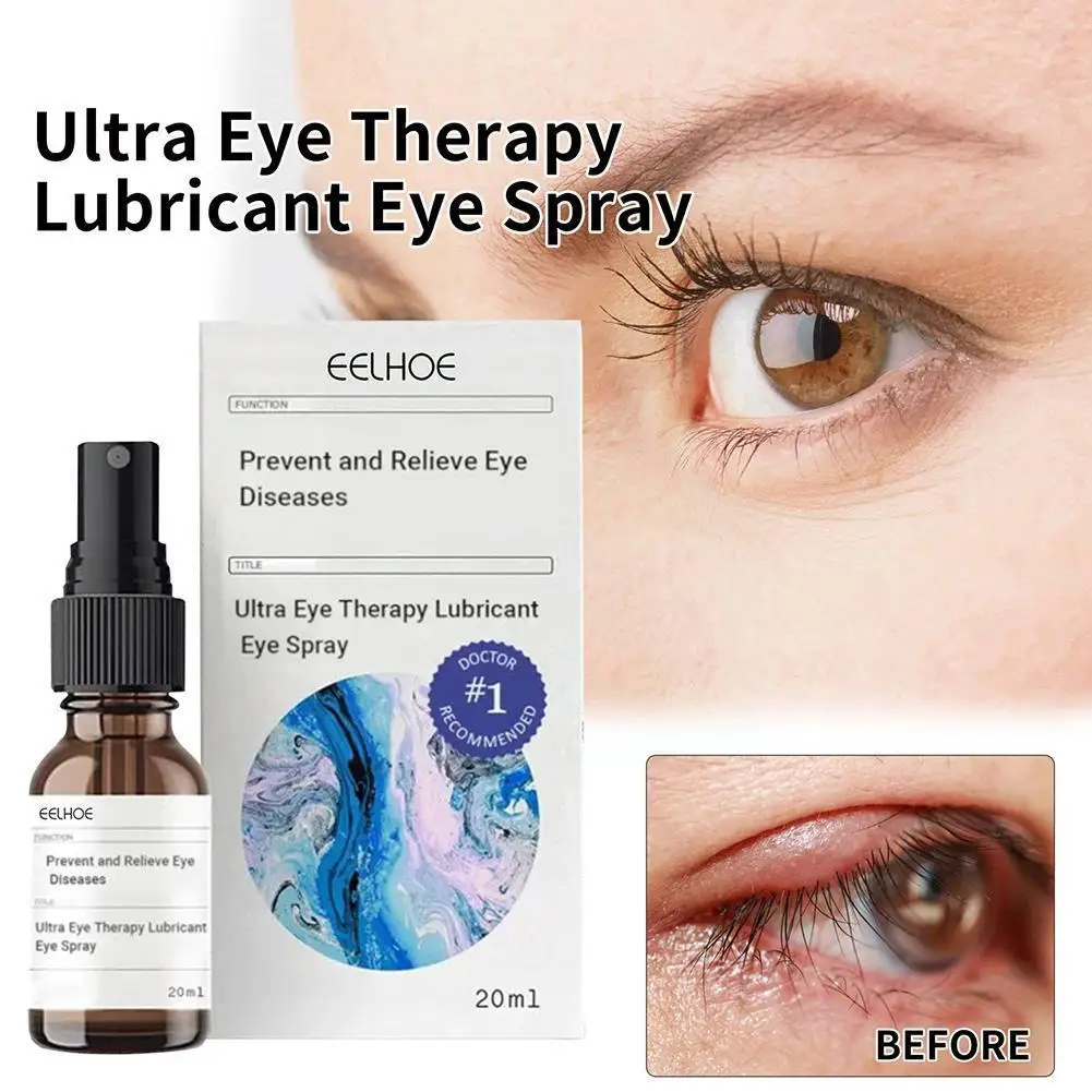 

20ml High-quality Eye Drops Relieve Eye Fatigue Eliminate Eye And The Sterilize Dry Eye Care Anti-inflammatory Moisturize E J5A6