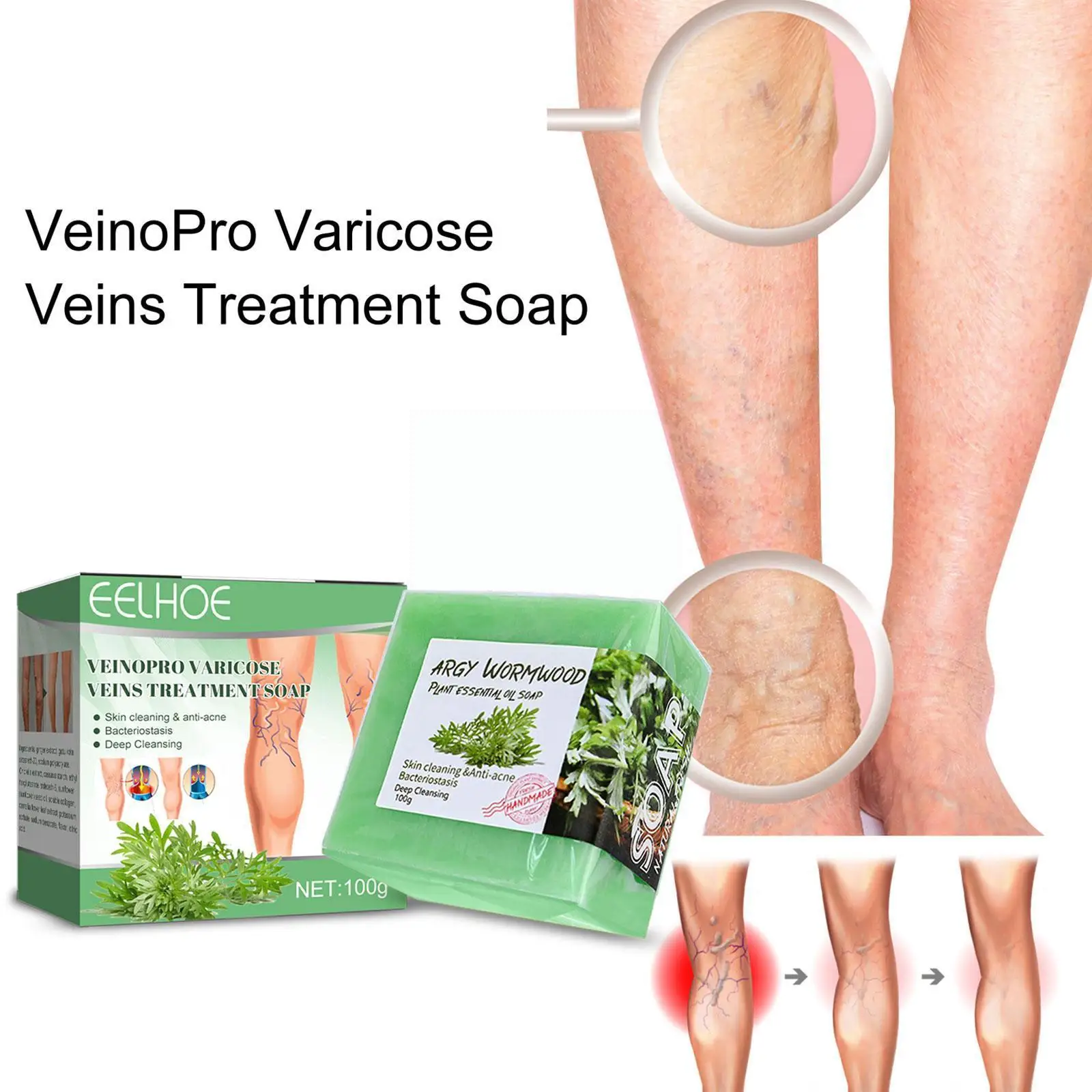 

Leg Vein Massage Repair Soap Clean Care Repair Earthworm Soap To Improve Soap Function Body And Works Flowbath Leg Blood K8i7