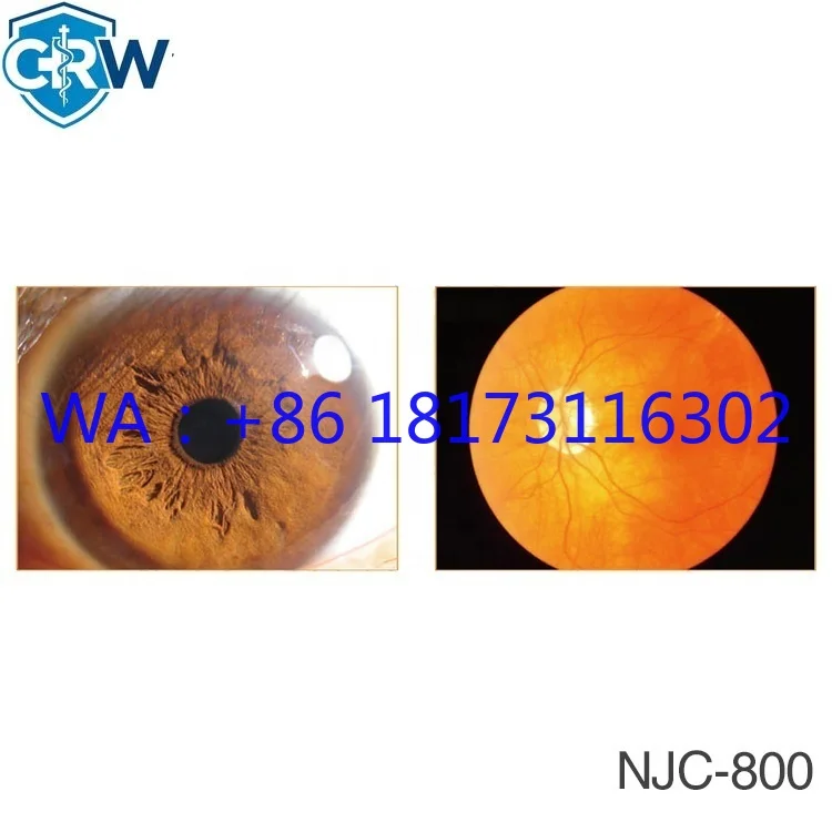 Офтальмоскоп Panoptic CRW NJC-800: Офтальмологическое оборудование для исследования глаз, широкопольный офтальмоскоп для продажи (art.: 3920db61935bf) - 3920db61935bf