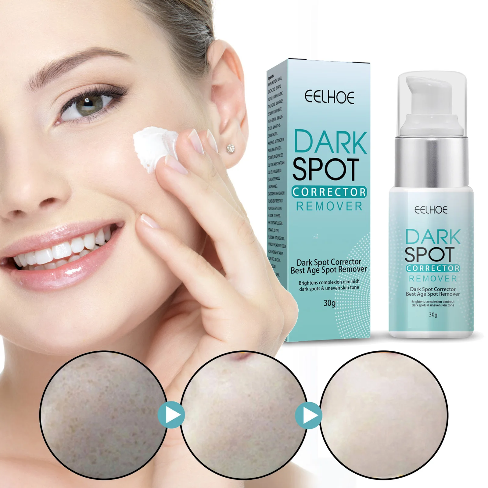 

30g Dark Spot Remover Corrector Age Spot Freckle Removal Emulsion Whitening Moisturizing Anti-Aging Repair Skin Care